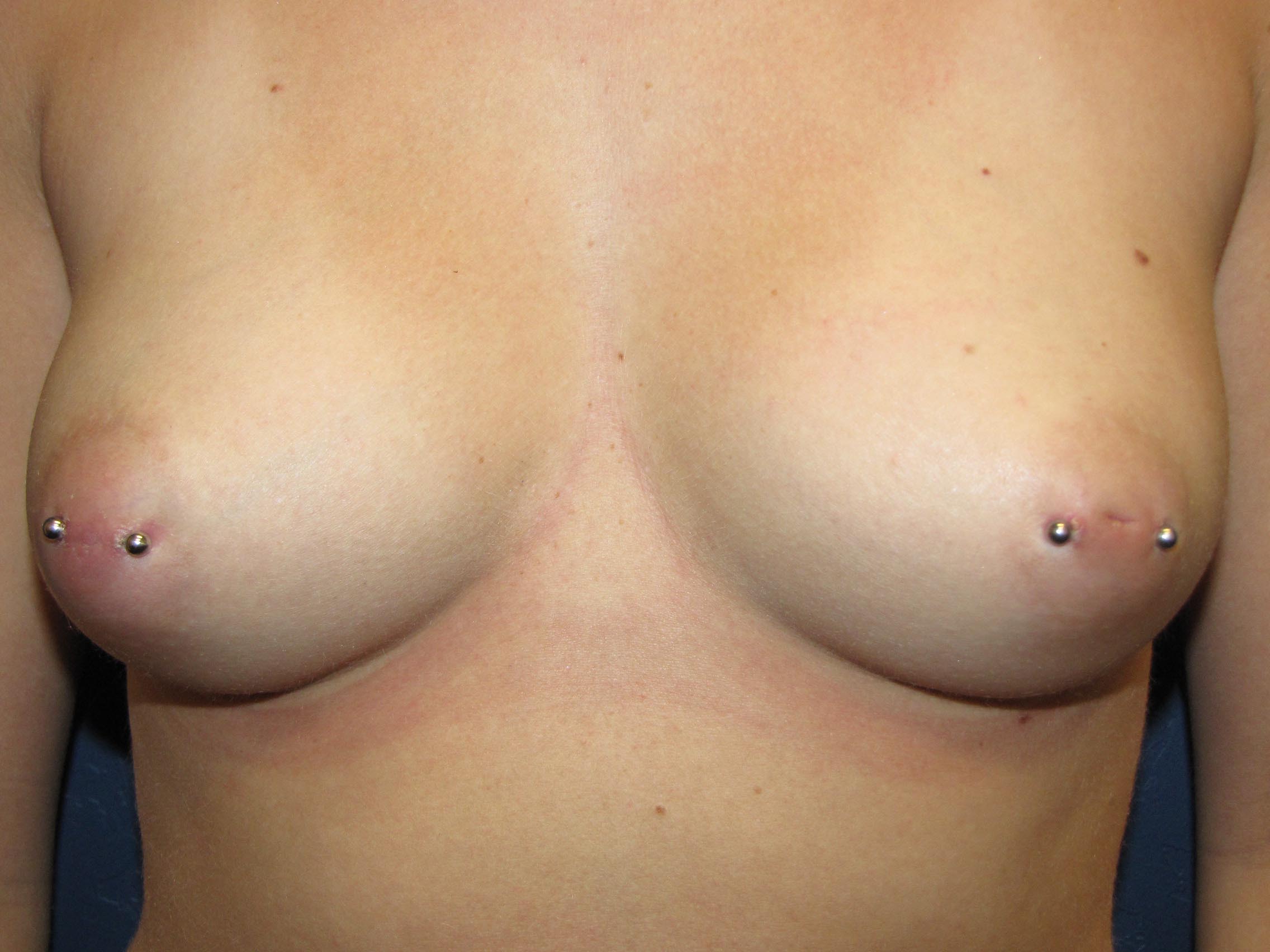 Фото женской груди с большими ареолами сосков фото