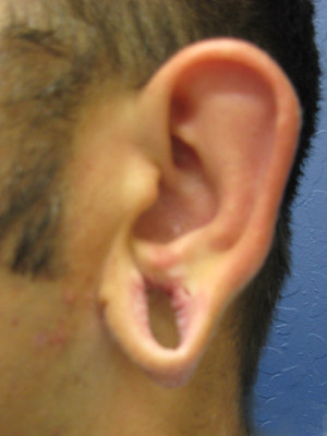 gauges ear