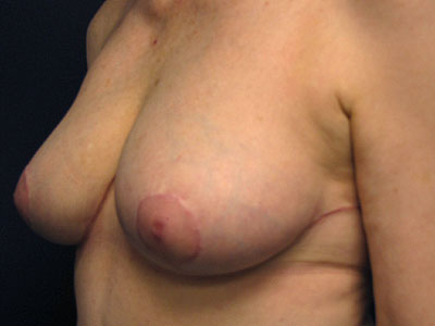 thumb joint splint atk full figured pussy