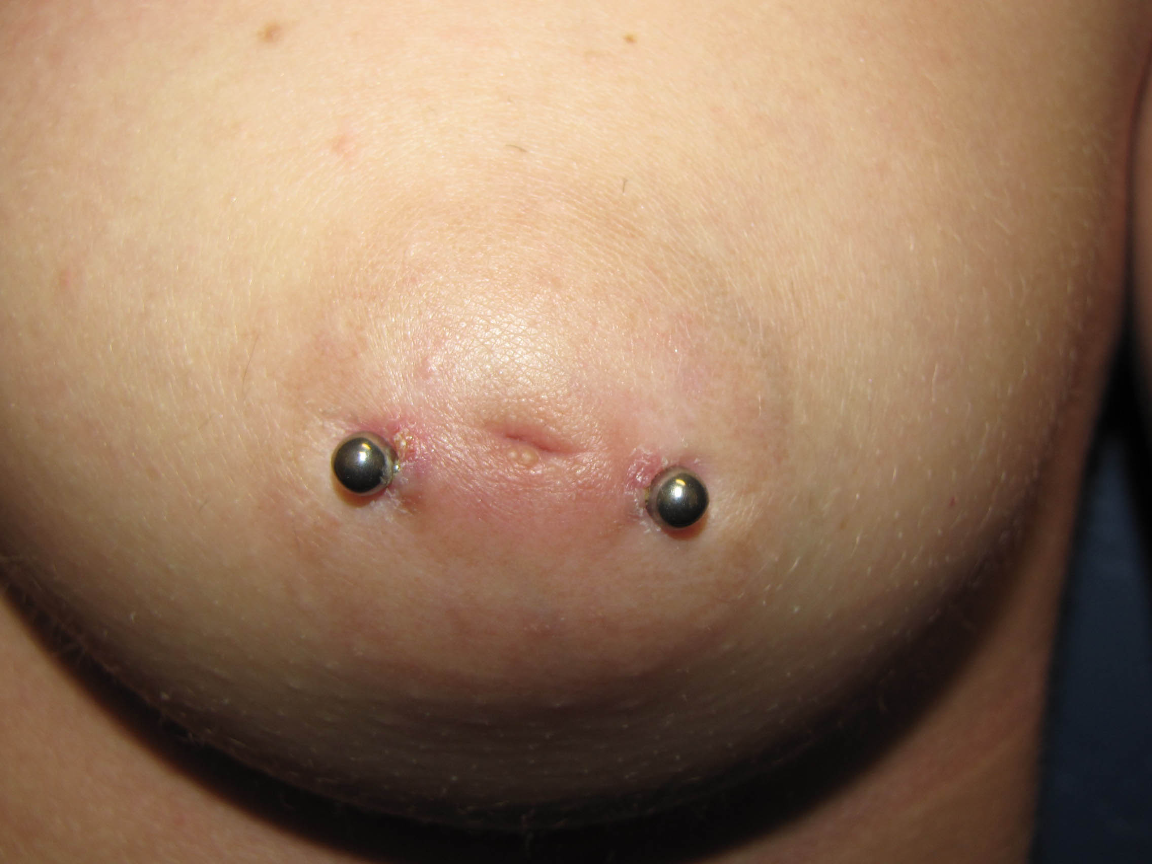 Inverted nipples piercing