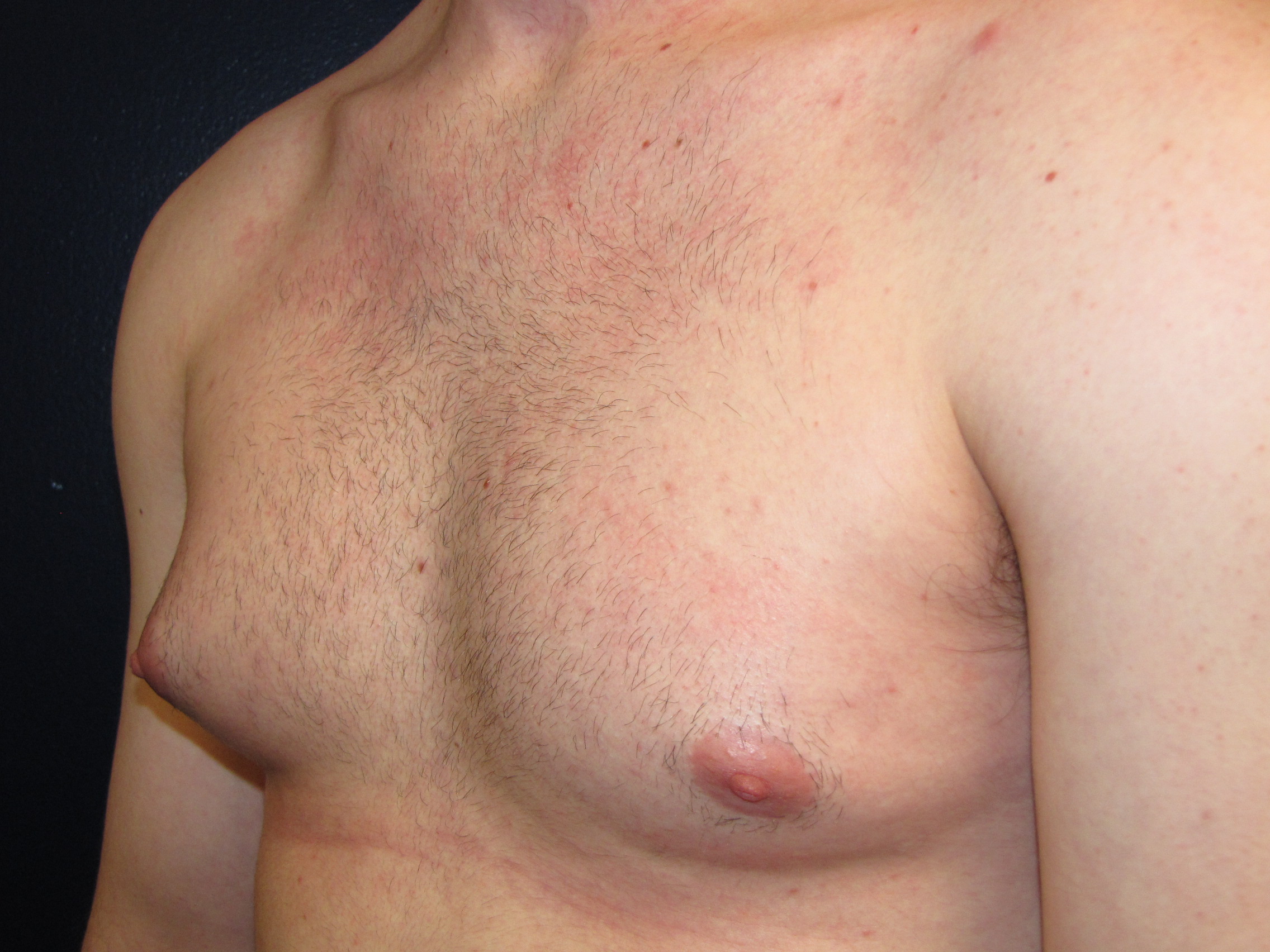 кожа у мужчин на груди фото 9